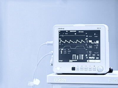 Remote ECG Monitoring